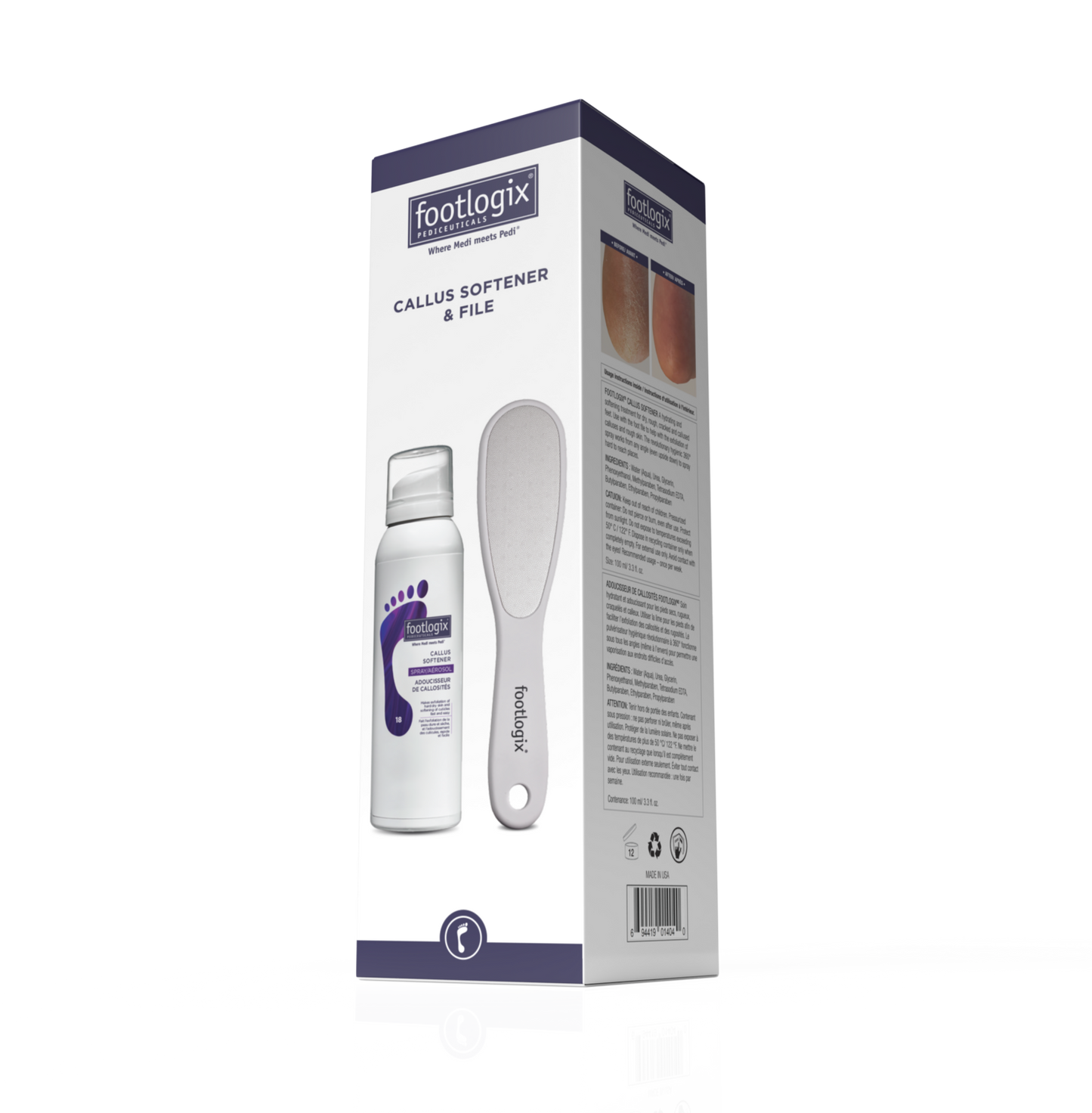 Footlogix At Home Kit